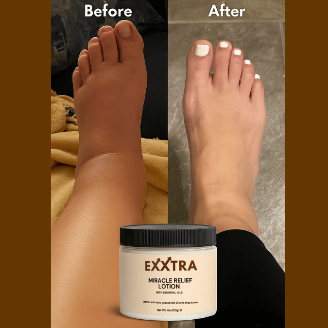 Miracle Relief Lotion - BUY 2 GET 1 (Doctor Recommended Lotion)